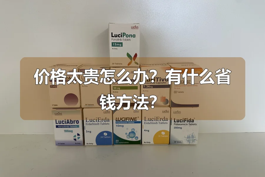 价格太贵怎么办?有什么省钱方法?